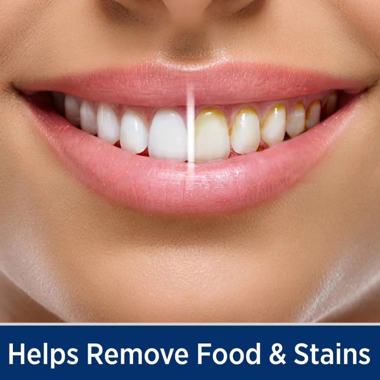 Ontel Miracle Smile - Irrigador dental para la salud de dientes y encí...